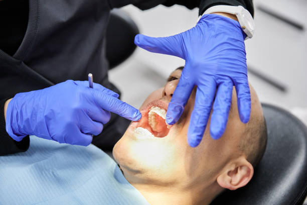 Best Emergency Tooth Extraction  in Camanche, IA