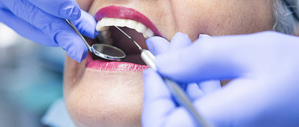 Best Urgent Tooth Repair  in Camanche, IA